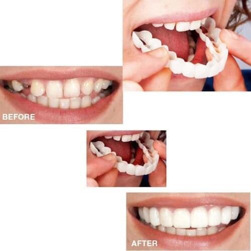 Plastic Upper Lower Veneers False Teeth Snap-on Denture Bright White Shade Fake Braces Veneers Snap-on Cement