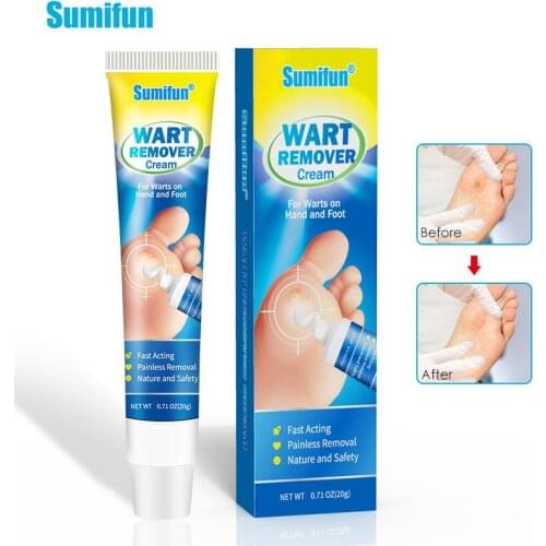 News 1box Wart Treatment Papillomas Removal of Warts Cream Skin Tags Removing Against Moles Remover Anti Verruca Remedy Cream
