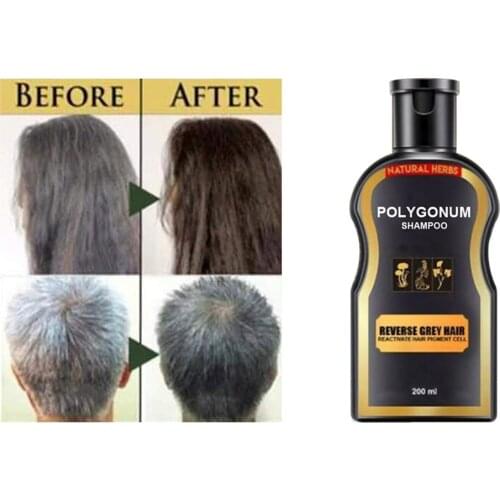 Polygonum Multiflorum Shampoo Anti-Dandruff Shampoo Moisturizing Refreshing Oil Control Shampoo Bright Hair Thickening Care