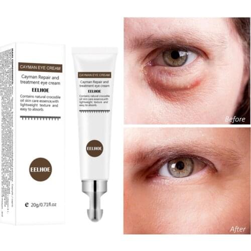 Eye Cream Hyaluronic Acid Aloe Serum Anti-Wrinkle Anti-Age Remove Dark Circles Eye Care Against Puffiness Bags Hydrate Eye Cream