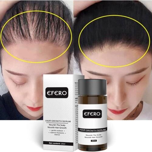 20ml Hair Growth Products Prevent Hair Loss Oil Fast Hair Regrowth Essence Restore Hair Roots Hairline Dense Hair Care Man Woman