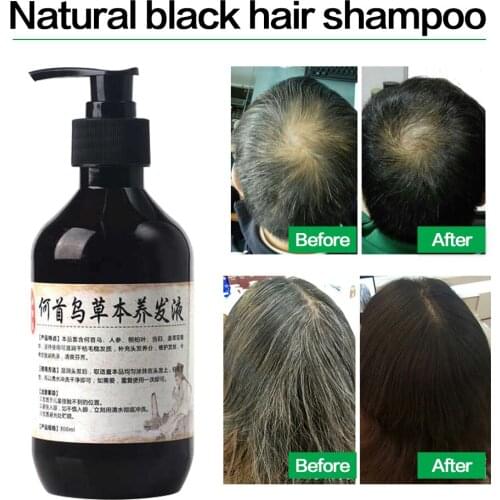Herbal Natural Polygonum Multiflorum Shampoo Plant Liquid Grey Hair White Hair Removal Turn Permanent Black Hair Care 300ml