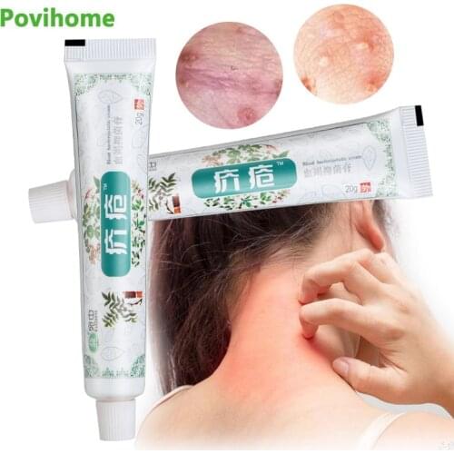 1Pcs 20g Pubic Lice Antipruritic Cream Remove Mites Dermatitis Eczema Psoriasis Treatment Ointment Skin Anti Itching Plaster