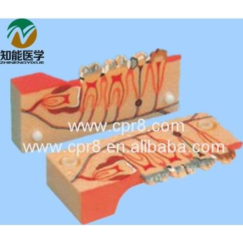 Tooth Decomposition Organization Model (Dental Model) BIX-L1003 WBW366