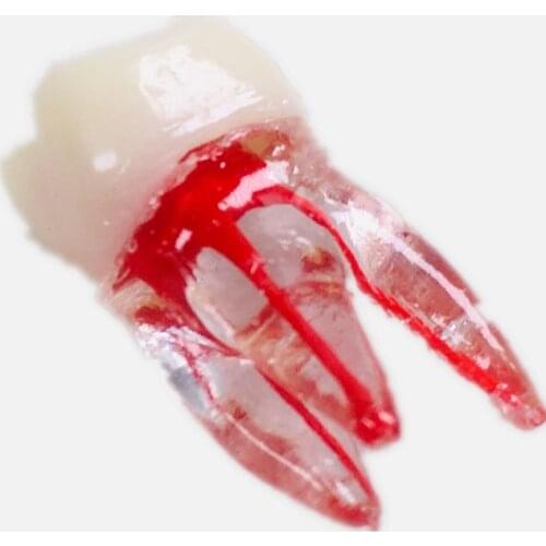 Dental Endo Tooth Root Canal Study Model For RCT Practice Block Pulp Cavity