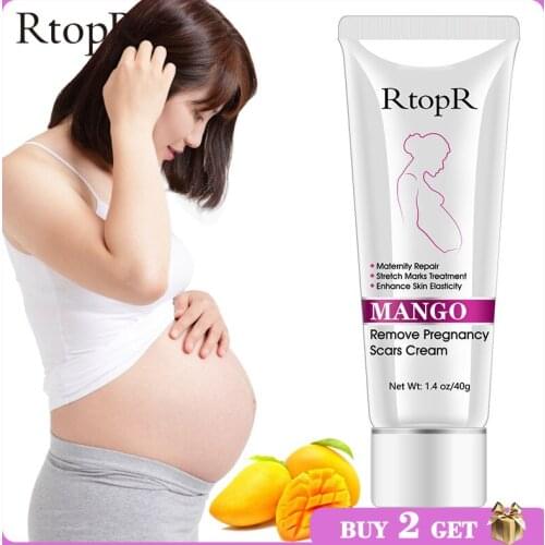 Mango Remove Pregnancy Scars Acne Cream Stretch Marks Treatment Maternity Repair Anti-Aging Anti-Winkles Firming Body Creams