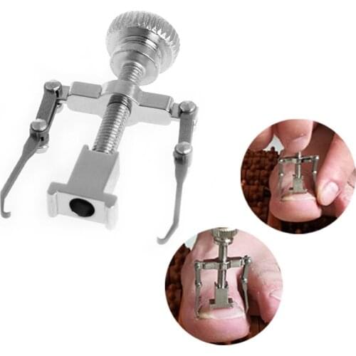 Ingrown Toe Nail Recover Correction Fixer Pedicure Tool Foot Nail Orthotic Lever Mechanics To Change The Angle Of Nail Growth