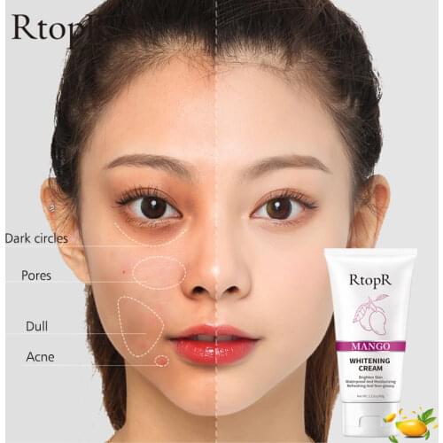 Whitening And Moisturizing Repair Skin Problems Dry Dull Brighten Skin Tone Perfect Skin Mango Whitening Moisturizing Cream