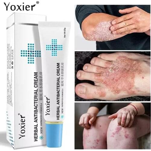 Yoxier Herbal Eczema Psoriasis Cream Antibacterial Dermatitis Cream Anti-itch Relief Skin Rash Urticaria Desquamation Treatment