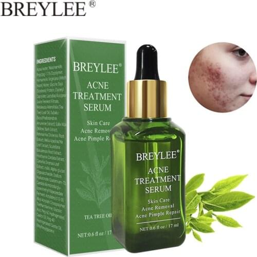 BREYLEE Acne Treatment Face Serum Pimple Acne Removal Anti Inflammation Shrink Pores Soothe Repair Damage Moisturizing Skin Care