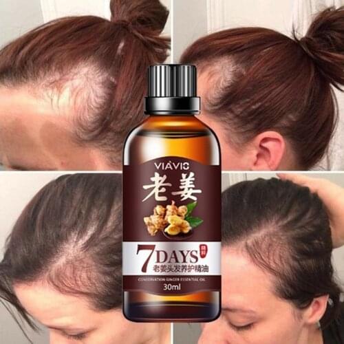 30ml Hair Growth Serum Essence For Women And Men Anti Preventing Hair Loss Alopecia Liquid Damaged Hair Repair Growing Faster