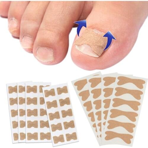 1PC Non-woven Fabric Toenail Corrector Ingrown Toe Foot Nail Correction Patch Nail Sticker
