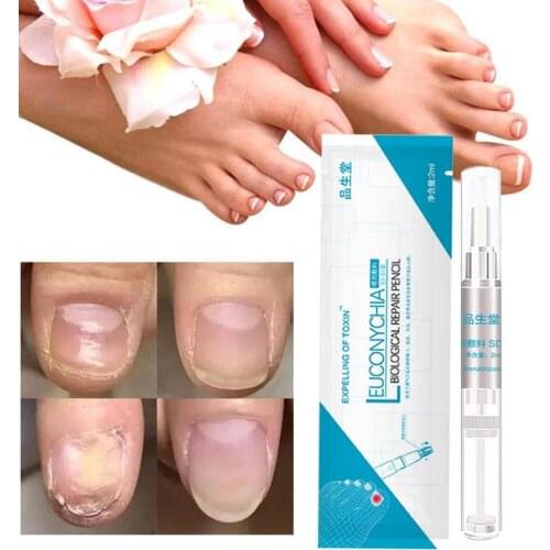 Nail Repair Liquid Pen Fungus Treatment Anti Fungal Remove Onychomycosis Biological Repair Rehydration Solution Nutrient Pencil