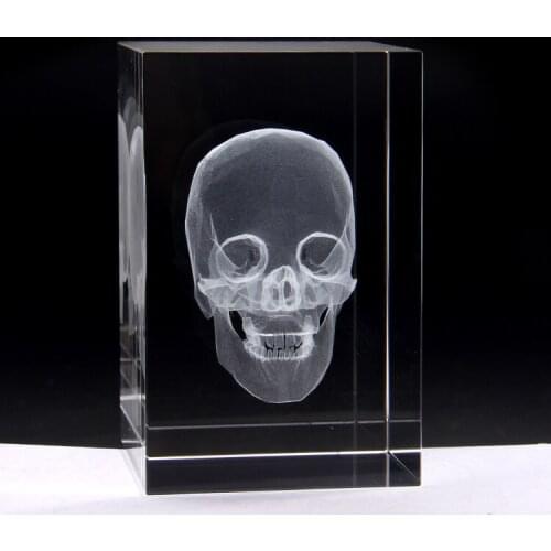 3D Stereo Crystal Internal Carbide Skull model education Medical model 5*5*8cm