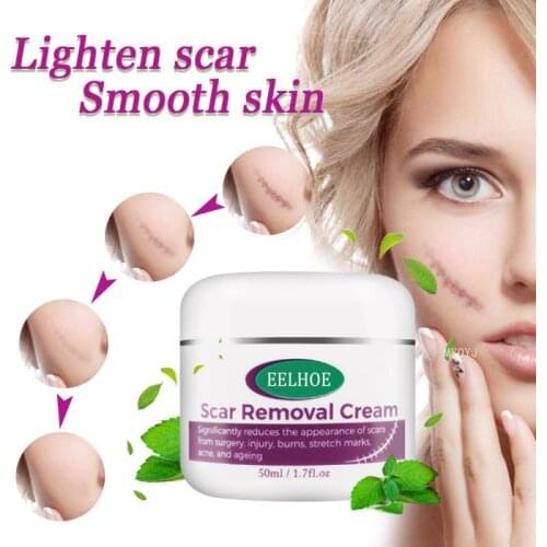 EELHOE 50ml Acne Scar Repair Cream For Strech Mark Scald Caesarean Bump Surgery Scar Removal Cream Treatment Body Care Dropship