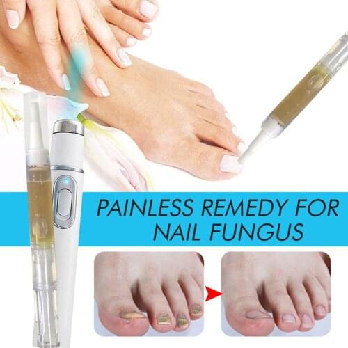 New Anti-fungal Home Treatment Set Toenail Treatment Pen Onychomycosis Paronychia Antifungal Fungus Care Repair Serum Kit