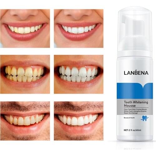 Teeth Whitening Mousse Clean Teeth Stain Freshens Breath Whiten Teeth Oral Teeth Cleaner Repair Oral Damage Freshens Breath