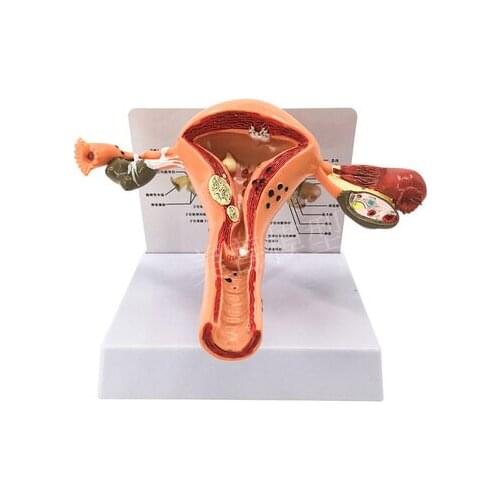 Female reproductive uterus model, vaginal ovary model, healthy teaching mould pathological change scientific teaching AIDS