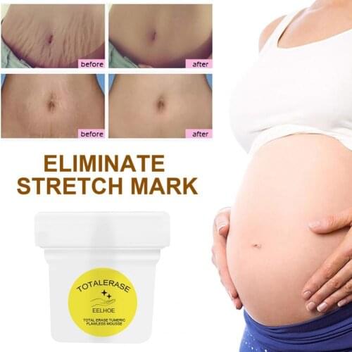 100g Skin-friendly Stretch Marks Remover Enhancing Skin Elasticity Liquid Maternity Scar Scratch Removal Supplies for Pregnant