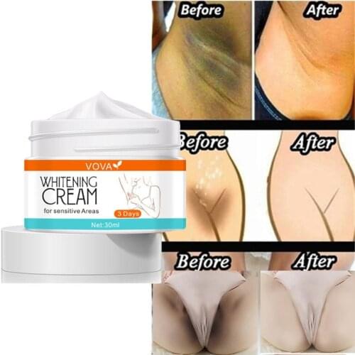 Whitening Cream for Dark Skin Bleaching Private Parts Sensitive Area Armpits Neck Knees Elbow Melanin Brightening Body Cream 30g