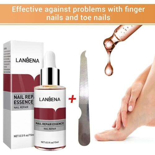Nail Treatments LANBENA Fungal Nail Feet Care Removal Fungus Healthy Repair Nail Art Tools Beauty Health