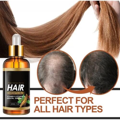 2 PCS Ginger Hair Growth Liquid Hair Sparse Treatment Of Healthy Strong Thick Hair Treatment Bald Fragile Sparse Hair Care Serum