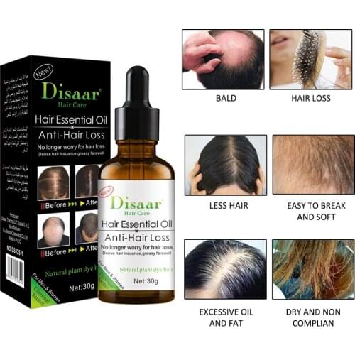30ML Hair Care Growth Essential Oil Strengthens Toughens Hair Quality Improves Manic Bifurcation Anti-Hair Loss