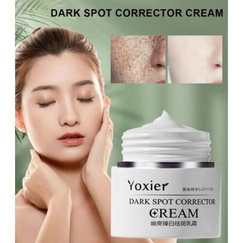 30g Remove Sunburn Dark Spots Skin Care Cream Whitening Moisturizing Anti-Aging Dark Spot Corrector Face Anti-spot Cream