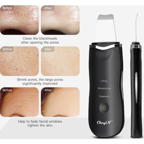 Professional Ultrasonic Facial Skin Scrubber Ion Deep Face Cleaning Peeling Rechargeable Skin Care Device Beauty Instrument