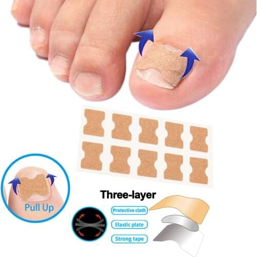 Ingrown Toenail Correction Patch Inlay Toenail Patch Painless Corrector Paronychia Fixer Recover Nail Patch Correction Pedicure