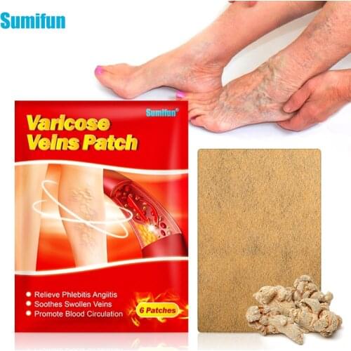 Sumifun 6pcs Herbal Varicose Veins Treatment Patch 100% Original Vasculitis Phlebitis Spider Varicosity Angiitis Medical Plaster