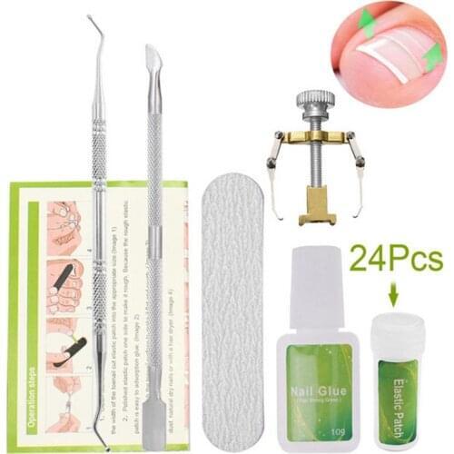 24pcs Patches Professional Ingrown Toe Nail Correction Pedicure Tools Foot Care Straighten Clip Toenail Protector Treatment Kit