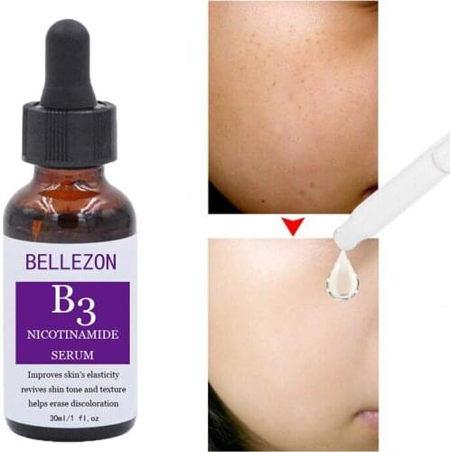 Niacinamide Essenc Face Essenc Hydrating Whitening Brighten Essence Repair Anti-aging Scar Removal Essenc Skin Care Serum