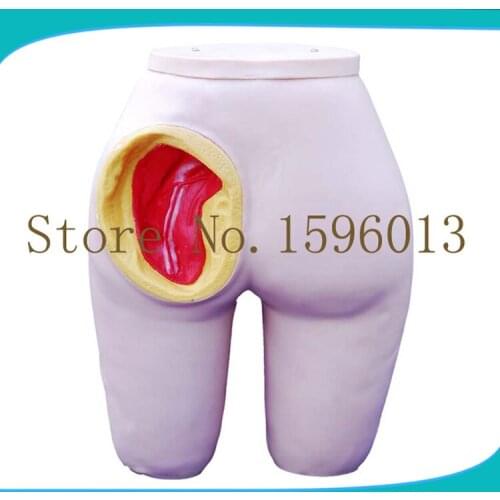Advanced Buttocks Intramuscular Injection Training Model, Hip injection simulator