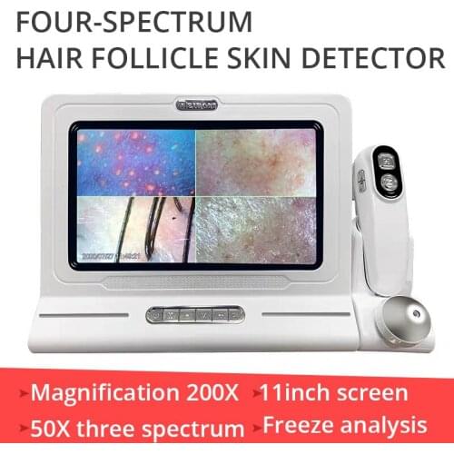 Scalp Detector Professional Hairs Follicle Instrument Head Skin Analyzer Capillary Analysis Parser News 2021 Technology for Home