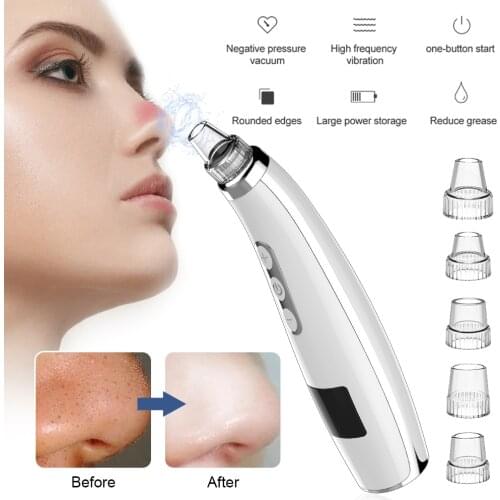 Facial Blackhead Remover Vacuum Electric Acne Cleaner Blackhead Black Point Vacuum Cleaner Tool Black Spots Pore Cleaner Machine
