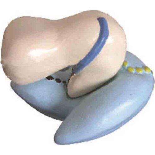 Ribosome amplification model