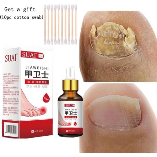 Nail Fungal Treatment Feet Care Essence Nail Foot Whitening Toe Nail Fungus Removal Gel Anti Infection Paronychia Onychomycosis