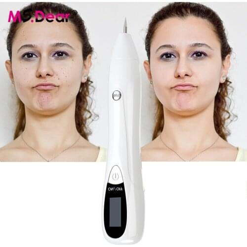 Laser Mole Tattoo Freckle Removal Pen LCD Sweep Spot Mole Removing Wart Corns Dark Spot Remover Salon Beauty Skin Care Machine