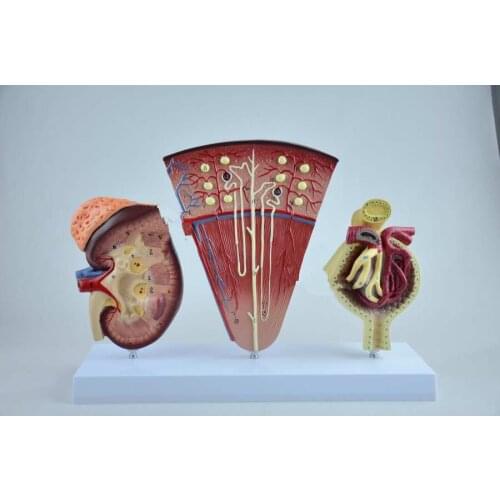 Kidney, nephron and glomerular model medical teaching kidney anatomical model