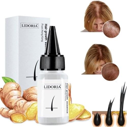 Ginger Fast Hair Growth Serum Essential Oil Anti Preventing Hair Lose Liquid Damaged Hair Repair Growing Dropship