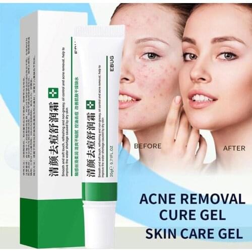 Effective Acne Removal Cream Acne Treatment Fade Acne Spots Oil Control Shrink Pores Whitening Moisturizing Acne Cream Skin Care