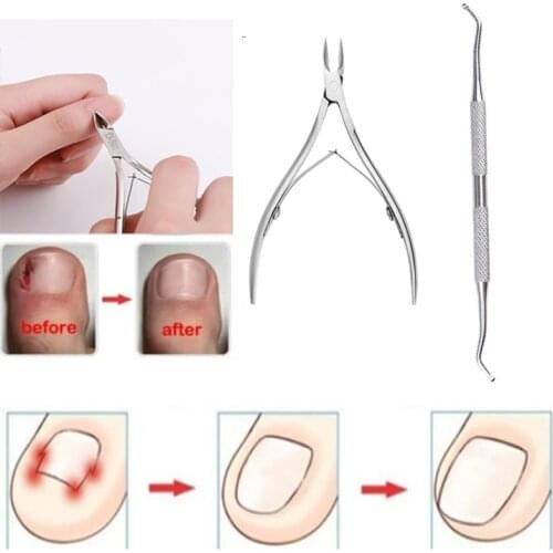 Ingrown Toenails Pedicure Foot Care Tool Nail Correction Clipper Cutters For Orthotic Acronyx Dead Skin Remover Podiatry