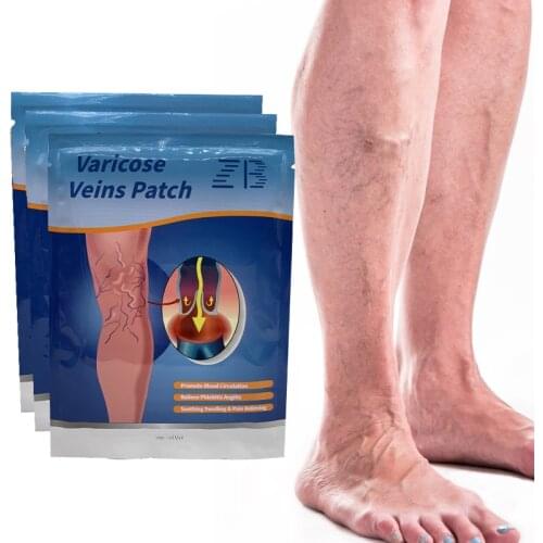 18/24/30 Pcs Varicose Veins Treatment Patch Removal Spider Leg Relief Feet Pain Anti-swelling Angiitis Vasculitis Plaster