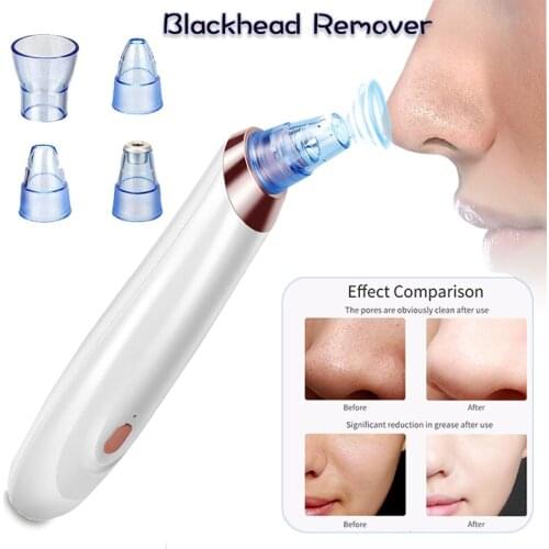 USB Blackhead Remover Pore Vacuum Cleaner Black Dot Nose Pore Acne Electric Facial Cleaning Pimple Removal Beauty Tool