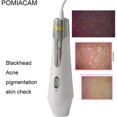 IS6 Precision Skin Oil Content Analyzer Facial Skin Meter Skin Care Tester Monitor Detector