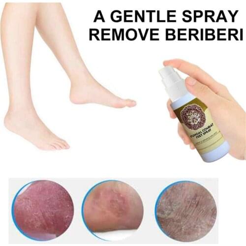60ml Herbal Spray Antibacterial Solution Odor Control Spraying Antibacterial Refreshing Feet Repair Spraying Deodorant