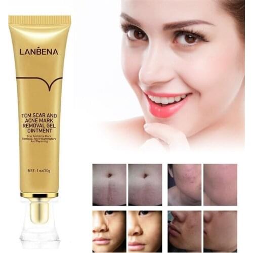TCM SCAR AND ACNE MARK REMOVAL GEL 30g Scar Gel Skin Repair Face Cream Acne Spots Acne Treatment SkinCare Whitening Stretch Mark