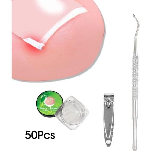 Toenail Correction set Pad Glue Extractor Nipper Ingrown Toe Nail Correction Sticker Patch Paronychia Correction File Foot Care