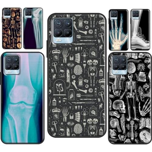 X-Ray Human Anatomy For OPPO Realme C21 C3 C15 X2 6 7 Pro GT Neo Case For OnePlus 9 Pro Nord 8T 8 Pro Cover